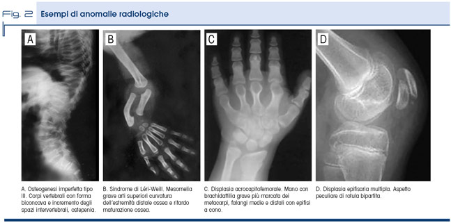 Fig. 2 - Esempi di anomalie radiologiche