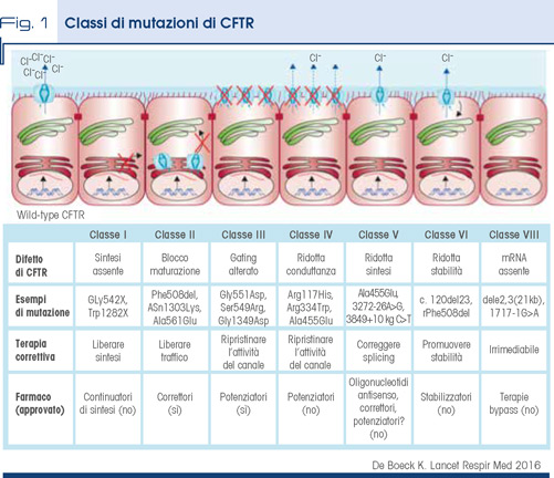 Fig. 1 - Classi di mutazioni di CFTR
