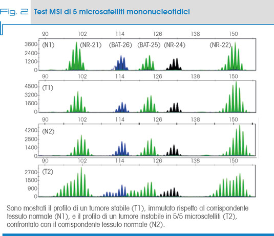 Fig. 2 Test MSI di 5 microsatelliti mononucleotidici