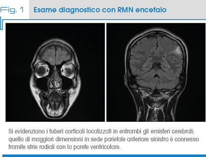 Fig. 1 Esame diagnostico con RMN encefalo