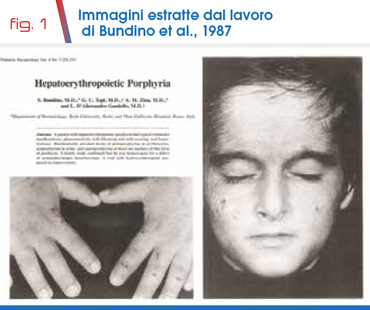 fig. 1 Immagini estratte dal lavoro di Bundino et al., 1987