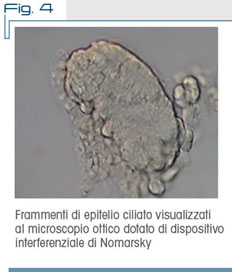Fig. 4 Frammenti di epitelio ciliato visualizzati al microscopio ottico dotato di dispositivo interferenziale di Nomarsky