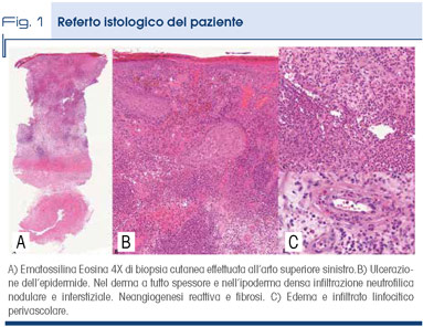 Fig. 1 - Referto istologico del paziente