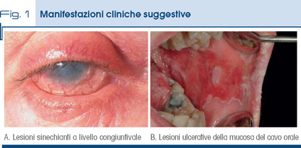Fig. 1 Manifestazioni cliniche suggestive