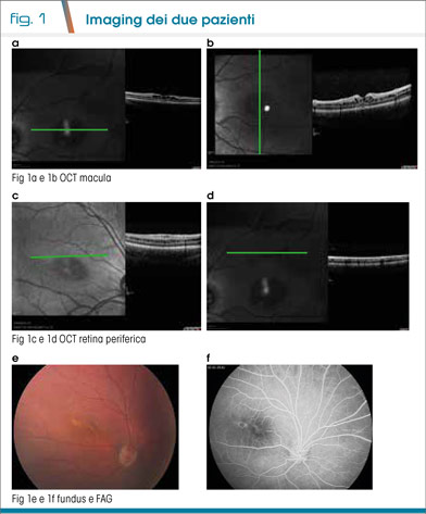 Fig1
