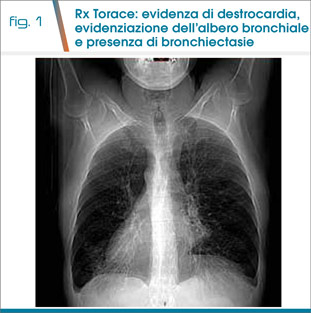 fig1
