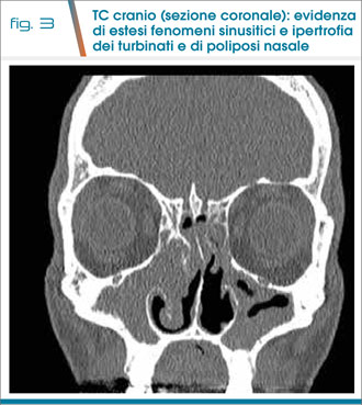 fig3
