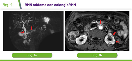 fig1