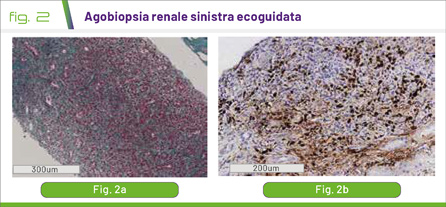 fig2