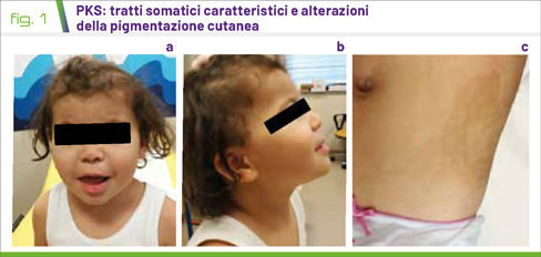 fig1