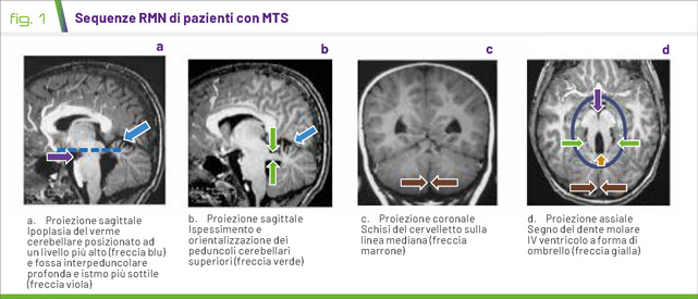 fig1