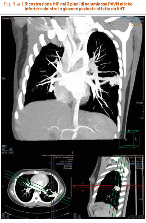 fig1a