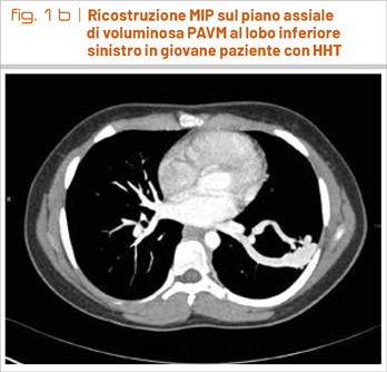 fig1b