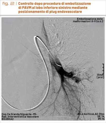 fig2