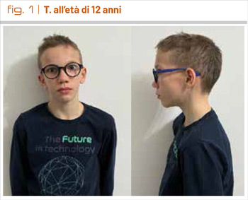 fig1