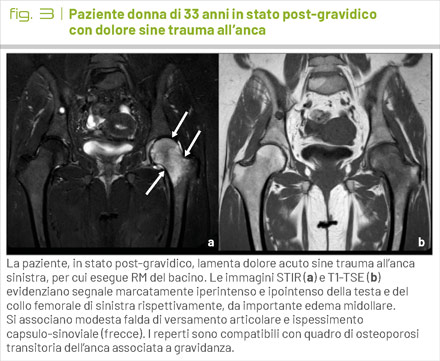 fig3