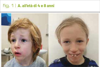 fig1
