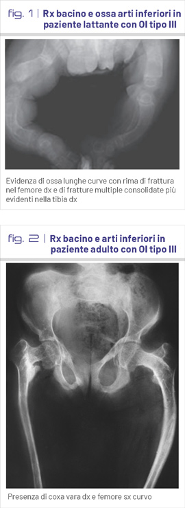 fig1-2