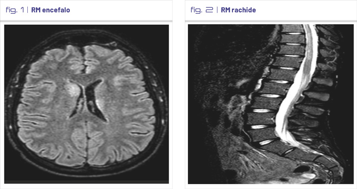 fig1-2