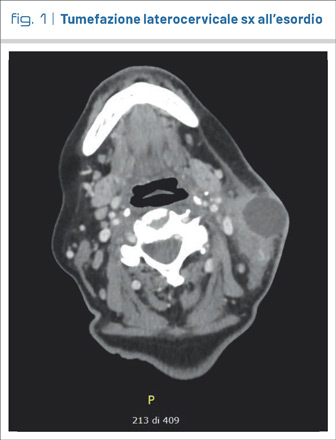 fig1