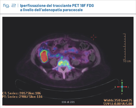 fig2