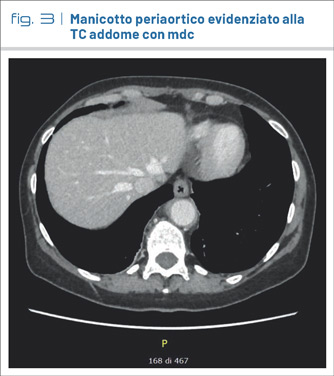 fig3