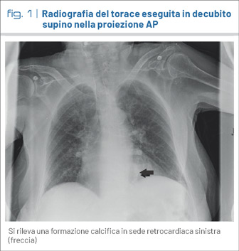 fig1