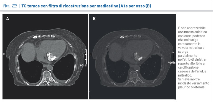 fig2
