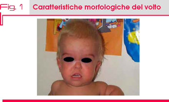 Fig. 1 Caratteristiche morfologiche del volto