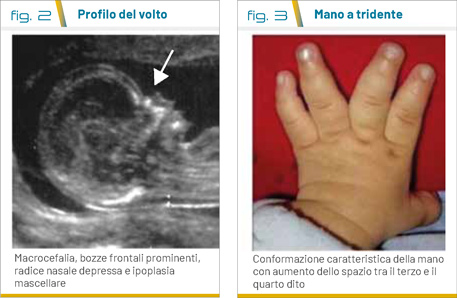 fig 2 e 3