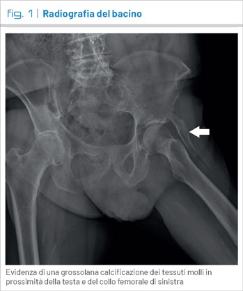 fig1