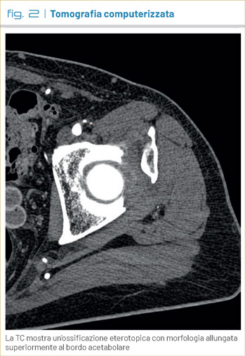 fig2