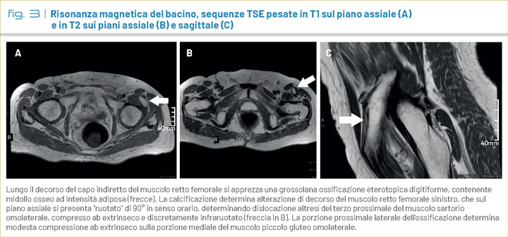 fig3