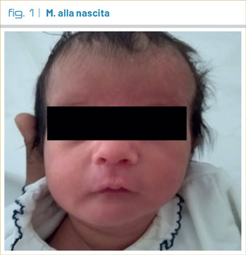 fig1