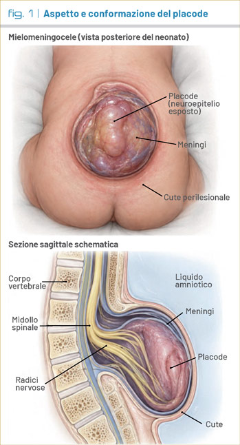 fig1