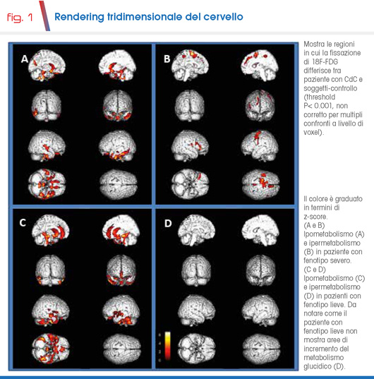 fig. 1 Rendering tridimensionale del cervello