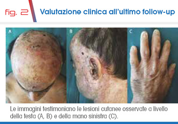  fig. 2 Valutazione clinica all’ultimo follow-up
