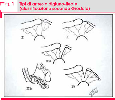 Fig. 1 Aspetti del viso del paziente prima  della correzione chirurgica della LPS